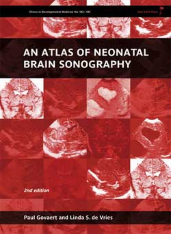 neonatalbrainsonography.jpg